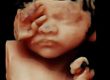 4d ultrasound scan