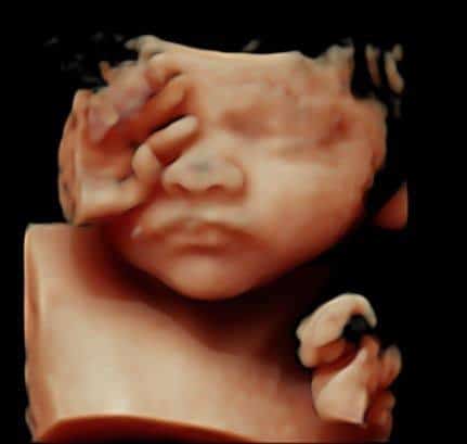 4d ultrasound scan