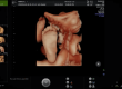 3d baby scan