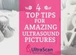 4 top tips for amazing ultrasound images