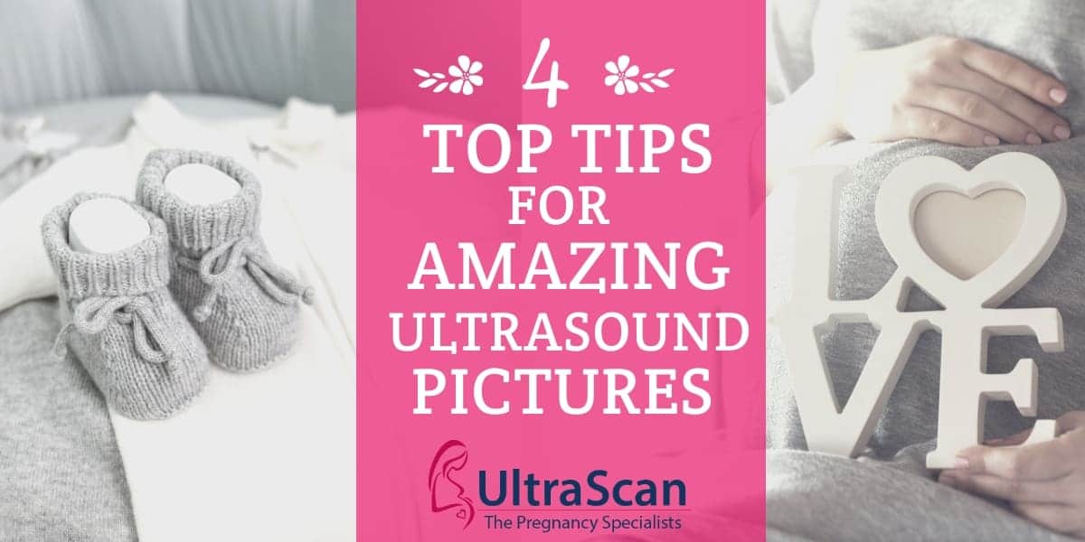 4 top tips for amazing ultrasound images