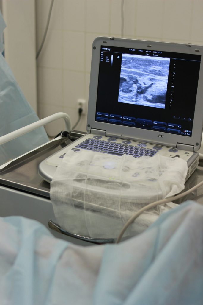 ultrasound baby scan